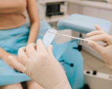 Pap smear sample is applied to a glass slide in the lab. Cytology sample is carefully placed on a glass slide for analysis. Gynecologist prepares a Pap smear slide with collected cells